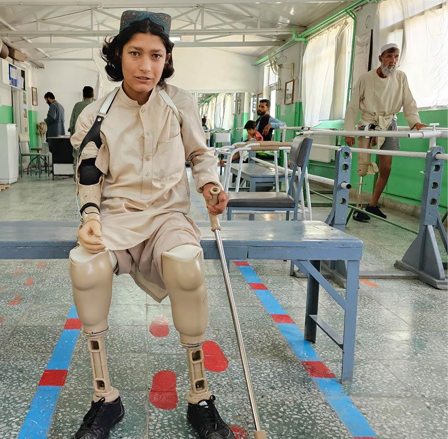 En ung mann på et fysisk rehabiliteringssenter i Kabul, etter å ha mistet begge ben og én arm etter at en mine eksploderte.
